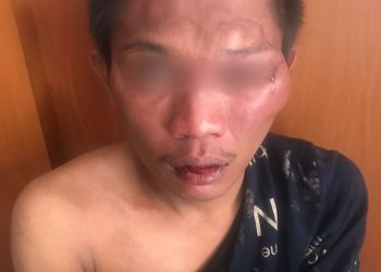 NL (28) warga Sukabumi Utara kebon jeruk Jakarta Barat babak belur di amuk warga usai melancarkan aksinya melakukan pencurian sepeda motor di jalan Kh H Muhdam Rt 006/001 Palmerah Jakarta Barat,