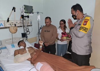 Kapolres Tabanan Jenguk Personil Bintara Remaja yang Mengalami Laka di RSU Sanglah